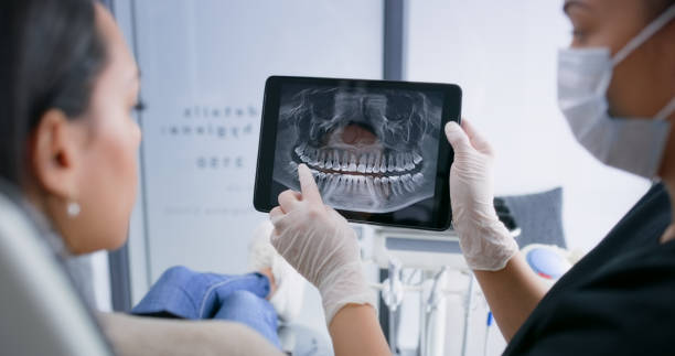 Licensed Tooth Extraction service in San Jose, CA - Smile Center Dentistry